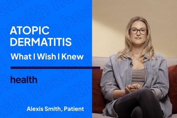 What I Wish I Knew Sooner About How People Really View My Eczema